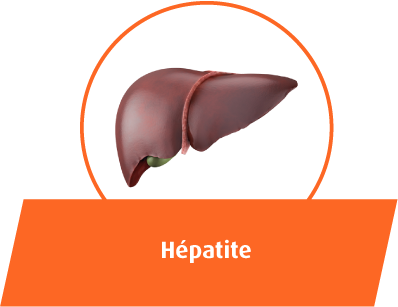 Hépatite
