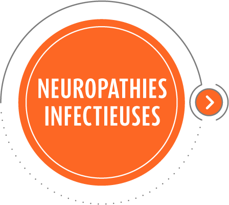 Infectieuses