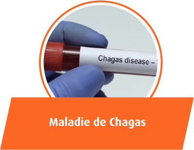 Maladie de Chagas