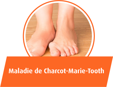 Maladie de Charcot-Marie-Tooth