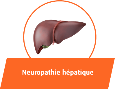 Neuropathie hepatique