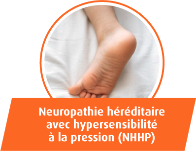 Neuropathie hereditaire