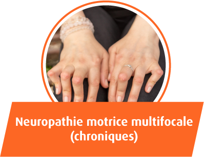 Neuropathie motrice