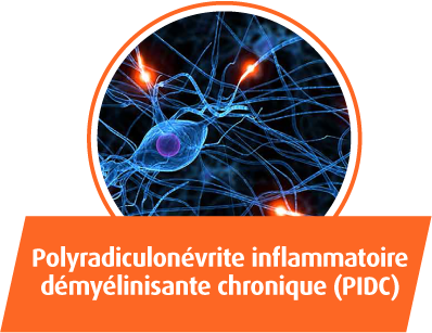 Polyradiculonevrite inflammatoire