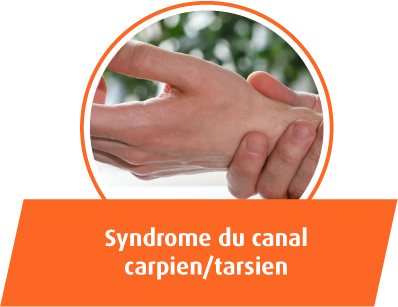 Syndrome du canal carpien tarsien